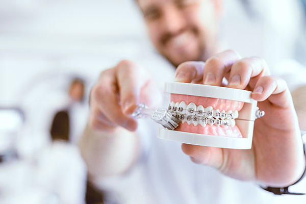 Types of Braces We Offer