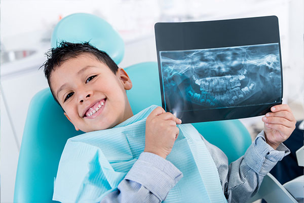 The Benefits of Digital Dental X-Rays