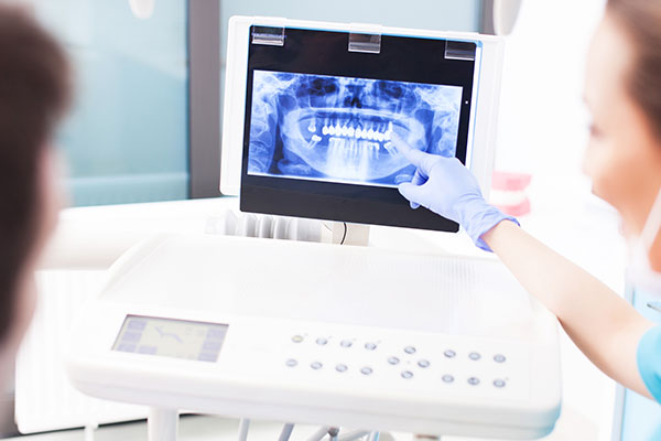 What to Expect During Your Digital X-Rays